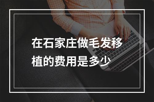 在石家庄做毛发移植的费用是多少