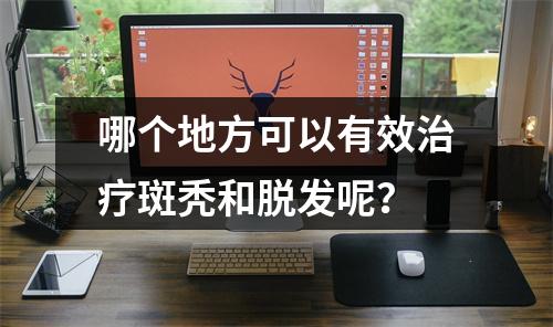 哪个地方可以有效治疗斑秃和脱发呢？