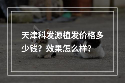 天津科发源植发价格多少钱？效果怎么样？