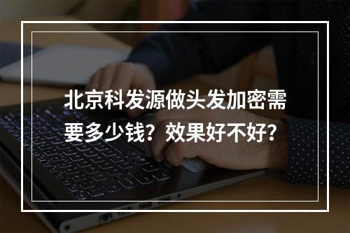 北京科发源做头发加密需要多少钱？效果好不好？