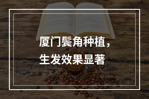 厦门鬓角种植，生发效果显著