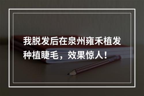 我脱发后在泉州雍禾植发种植睫毛，效果惊人！