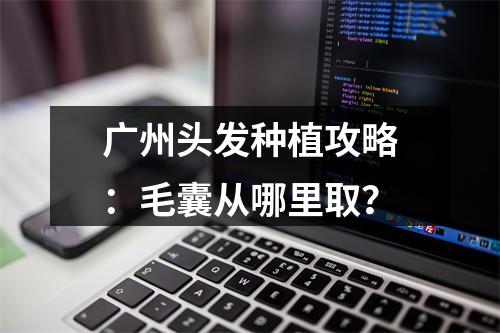 广州头发种植攻略：毛囊从哪里取？