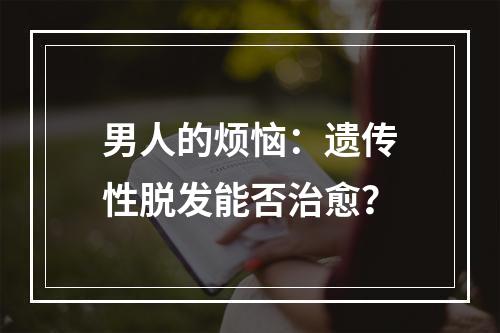 男人的烦恼：遗传性脱发能否治愈？