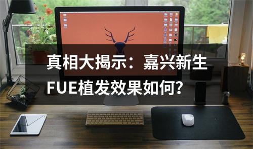 真相大揭示：嘉兴新生FUE植发效果如何？