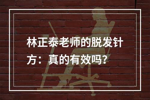 林正泰老师的脱发针方：真的有效吗？