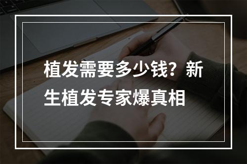 植发需要多少钱？新生植发专家爆真相