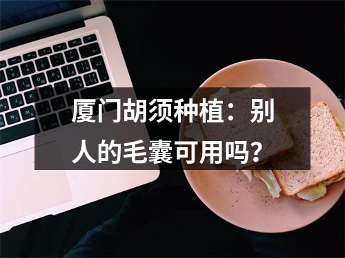 厦门胡须种植：别人的毛囊可用吗？