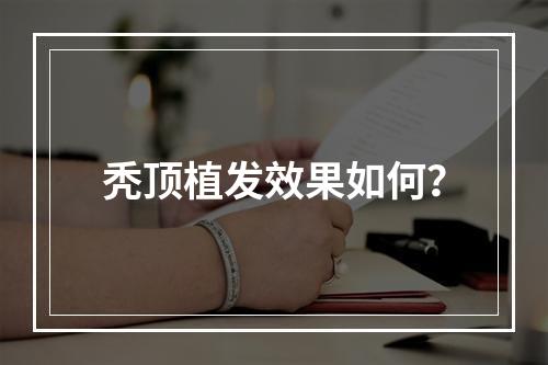 秃顶植发效果如何？