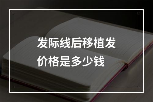 发际线后移植发价格是多少钱