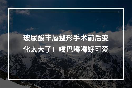 玻尿酸丰唇整形手术前后变化太大了！嘴巴嘟嘟好可爱