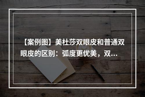 【案例图】美杜莎双眼皮和普通双眼皮的区别：弧度更优美，双眼更自然~