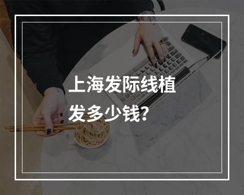 上海发际线植发多少钱？