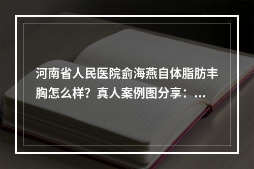 河南省人民医院侴海燕自体脂肪丰胸怎么样？真人案例图分享：前后差太大了！