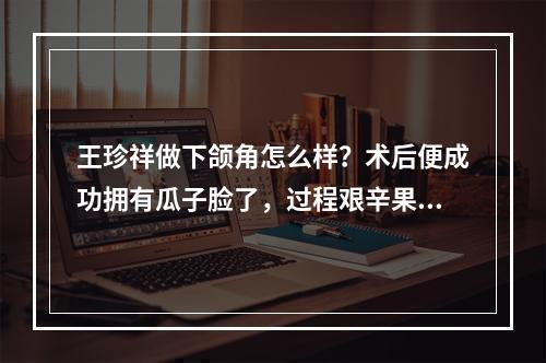 王珍祥做下颌角怎么样？术后便成功拥有瓜子脸了，过程艰辛果满意！