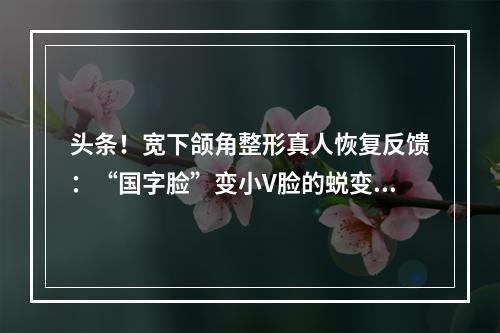 头条！宽下颌角整形真人恢复反馈：“国字脸”变小V脸的蜕变~