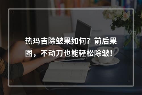 热玛吉除皱果如何？前后果图，不动刀也能轻松除皱！