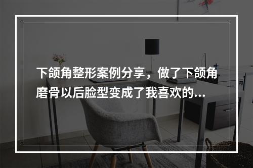 下颌角整形案例分享，做了下颌角磨骨以后脸型变成了我喜欢的瓜子脸