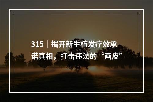 315｜揭开新生植发疗效承诺真相，打击违法的“画皮”