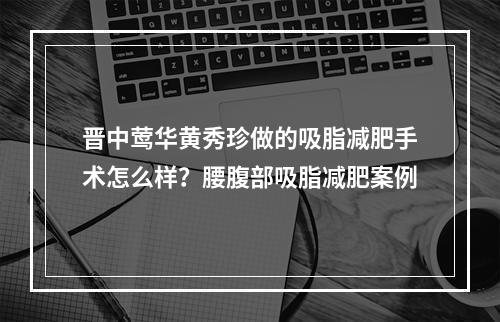 晋中莺华黄秀珍做的吸脂减肥手术怎么样？腰腹部吸脂减肥案例