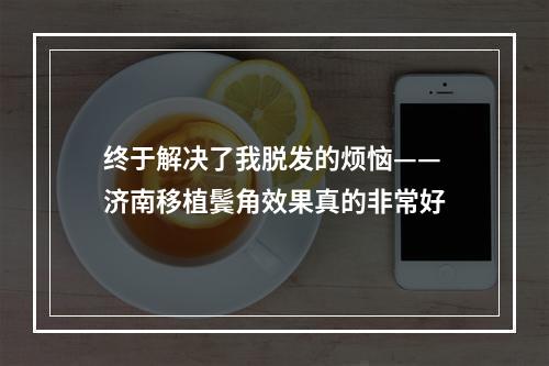 终于解决了我脱发的烦恼——济南移植鬓角效果真的非常好