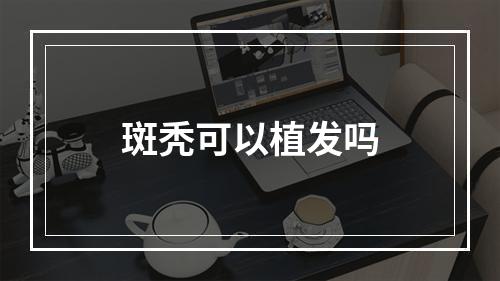 斑秃可以植发吗