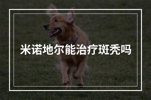 米诺地尔能治疗斑秃吗