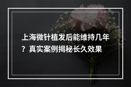 上海微针植发后能维持几年？真实案例揭秘长久效果