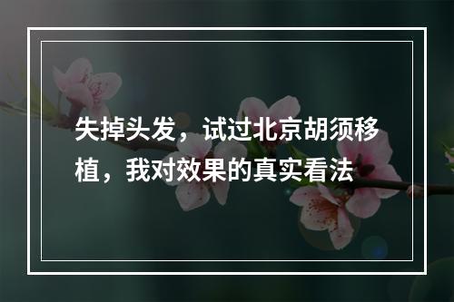 失掉头发，试过北京胡须移植，我对效果的真实看法