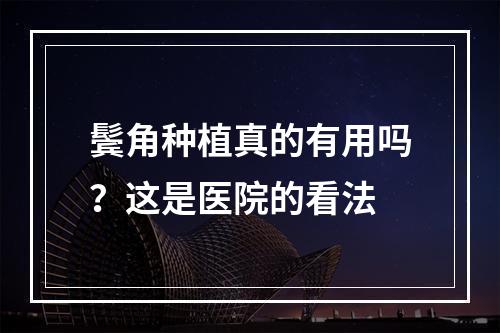 鬓角种植真的有用吗？这是医院的看法