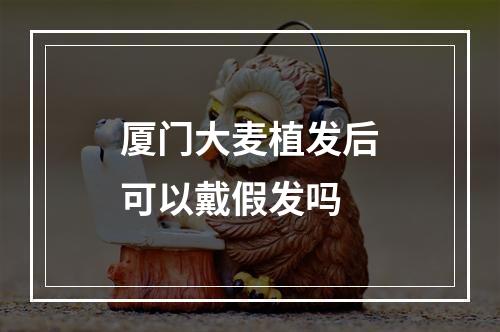 厦门大麦植发后可以戴假发吗