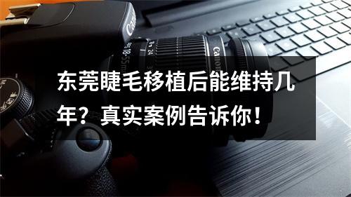 东莞睫毛移植后能维持几年？真实案例告诉你！