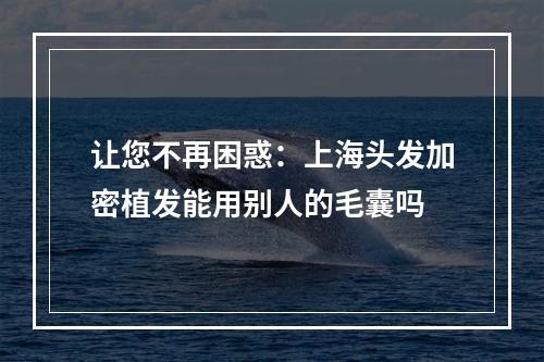 让您不再困惑：上海头发加密植发能用别人的毛囊吗