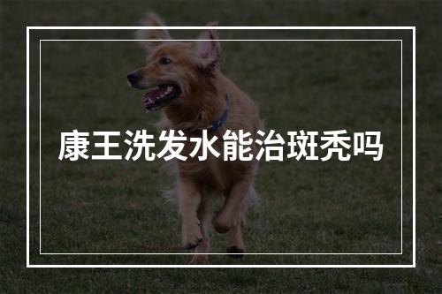 康王洗发水能治斑秃吗