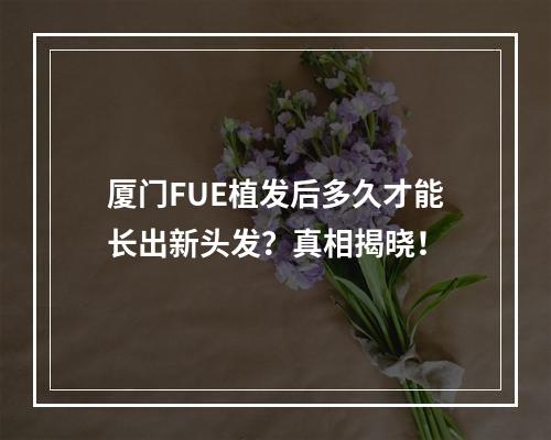 厦门FUE植发后多久才能长出新头发？真相揭晓！