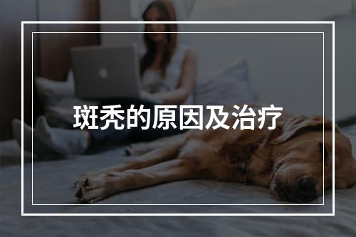 斑秃的原因及治疗