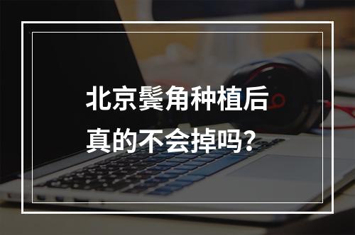 北京鬓角种植后真的不会掉吗？