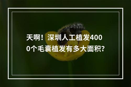 天啊！深圳人工植发4000个毛囊植发有多大面积？