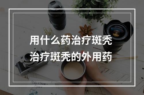 用什么药治疗斑秃 治疗斑秃的外用药