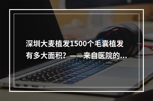 深圳大麦植发1500个毛囊植发有多大面积？——来自医院的解答