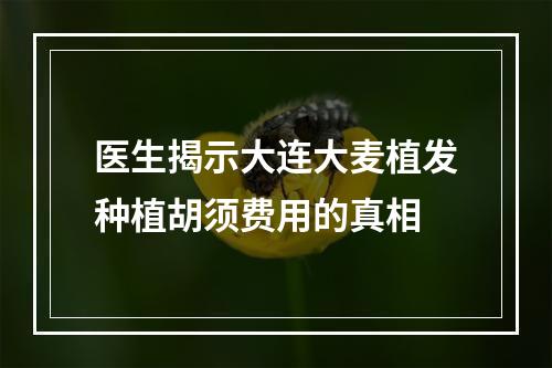 医生揭示大连大麦植发种植胡须费用的真相