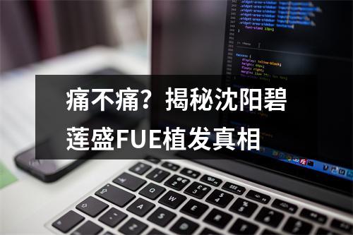 痛不痛？揭秘沈阳碧莲盛FUE植发真相