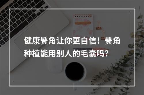 健康鬓角让你更自信！鬓角种植能用别人的毛囊吗？