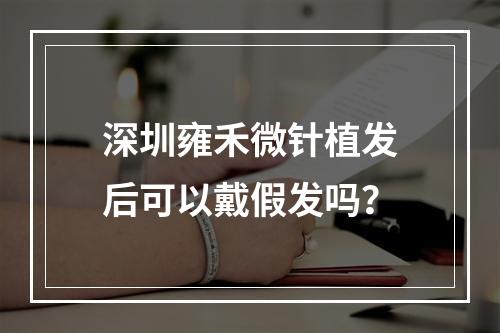 深圳雍禾微针植发后可以戴假发吗？