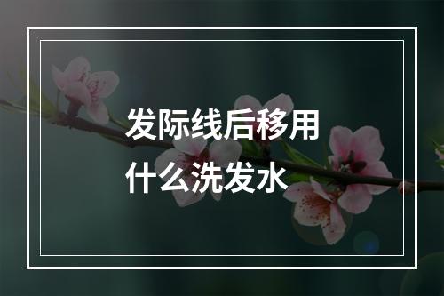 发际线后移用什么洗发水