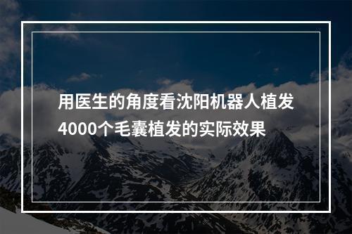 用医生的角度看沈阳机器人植发4000个毛囊植发的实际效果