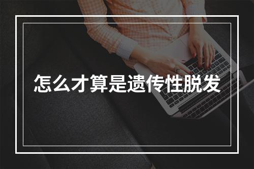 怎么才算是遗传性脱发