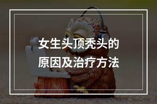 女生头顶秃头的原因及治疗方法