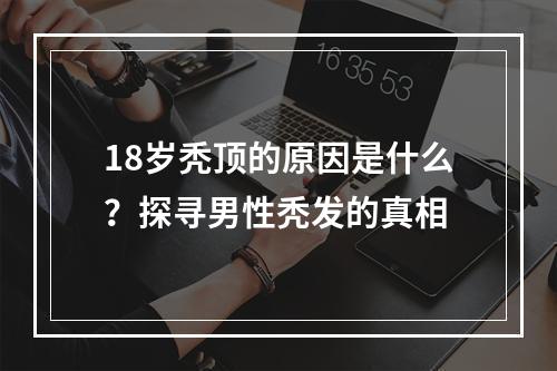 18岁秃顶的原因是什么？探寻男性秃发的真相