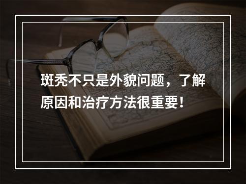 斑秃不只是外貌问题，了解原因和治疗方法很重要！